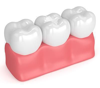 Image related to a dental practice located in Woodland, CA called Brian Lin D.D.S.